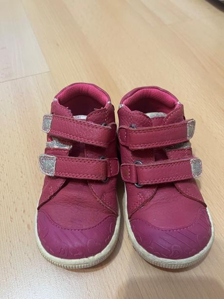 Poltopanky protetika, protetika,22