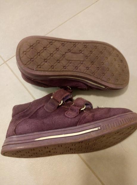 Topánky kožené, protetika,29