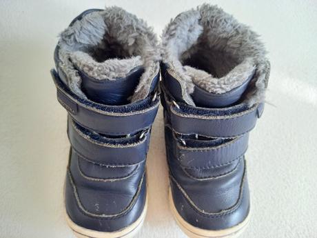 Čižmy protetika, protetika,22