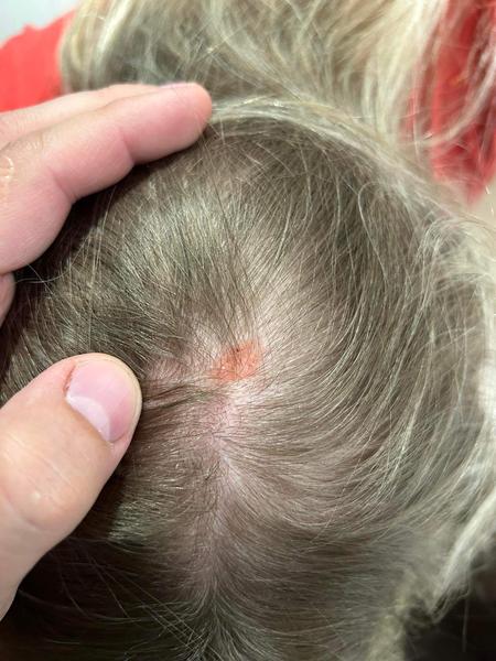 Čo to mám na hlave?