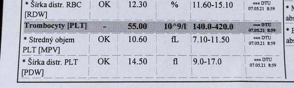 Čo znamenajú znížené trombocyty?