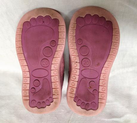 Ruzove topanocky, protetika,20