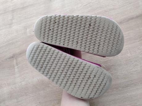 Papučky protetika, protetika,30