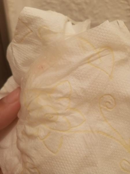 Bieložltý výtok v 39. týždni