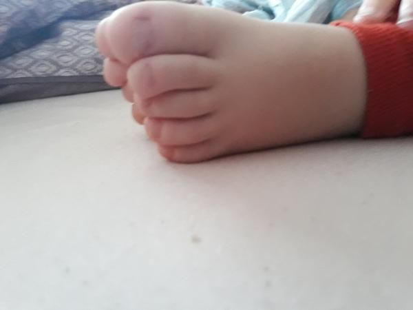 Nosí môj syn nesprávnu obuv?