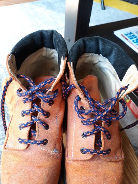 Prechodne ortopedicke topanky, protetika,29