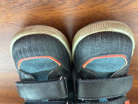 Topanky protetika, protetika,23