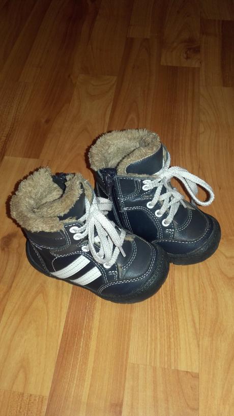 Topanky, protetika,21