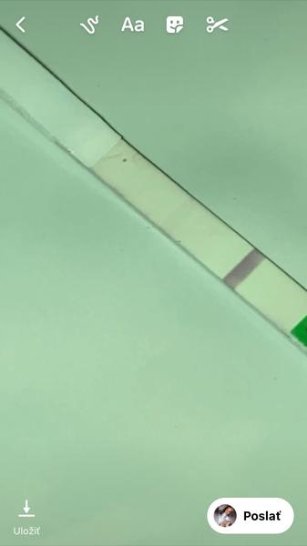 Býva mi zle, mám chuť na sladké a nafúknuté brucho