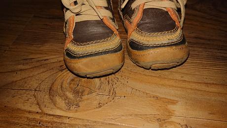 Protetika chlapčenské topánky na zips, protetika,19