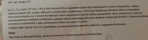 Aký sú mojej výsledky z MR?