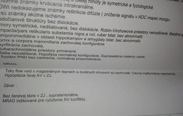 Vysvetlíte mi záver vyšetrenia MRI mozgu?