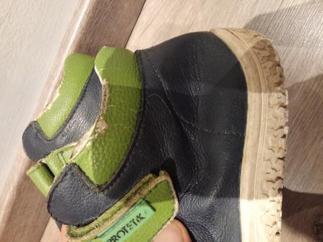 Kožené prechodné topánky protetika alternatíva, protetika,31