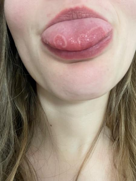 Čo to mám na jazyku?