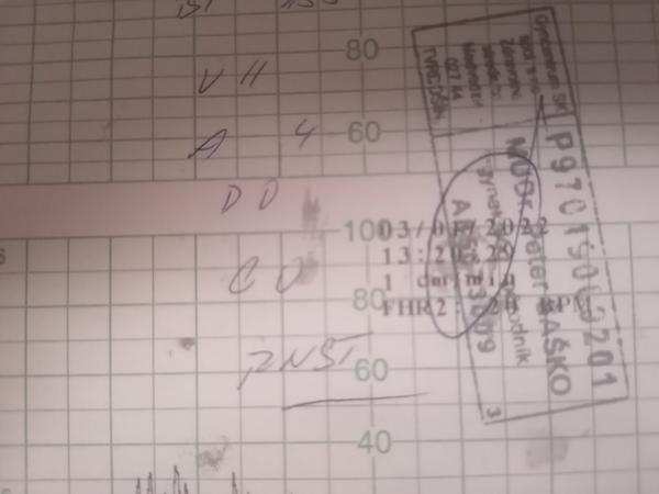 Mám podľa výsledkov otvorený krčok na 1 cm?