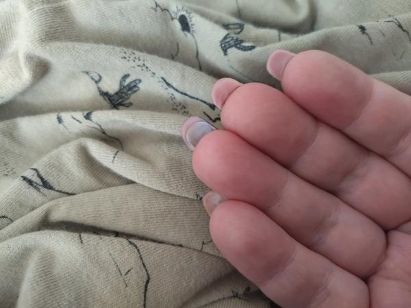 Kedy odstrániť nevydarené nechtové úpravy?