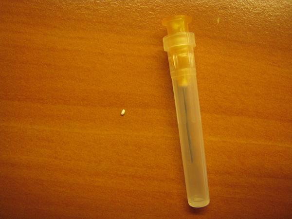 Zrnko "krupica" v prsníku - v mliekovode