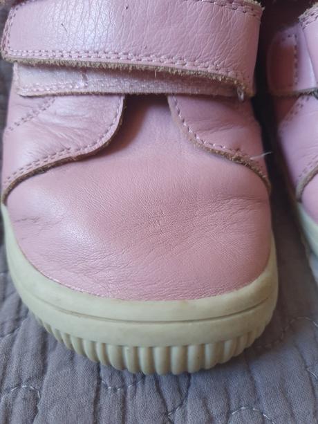 Protetika barefoot prechodné topánky, protetika,33