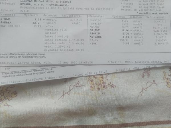 Výsledky testov z predoperačného vyšetrenia v 35tt