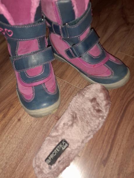 Čižmy sú, protetika,32