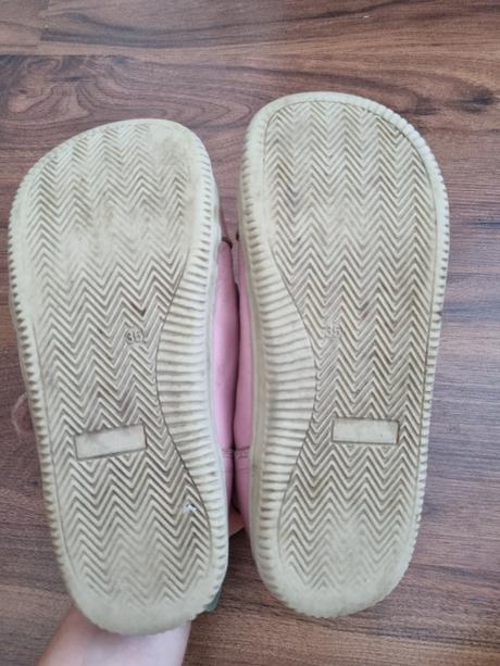 Barefoot topánky protetika, protetika,35