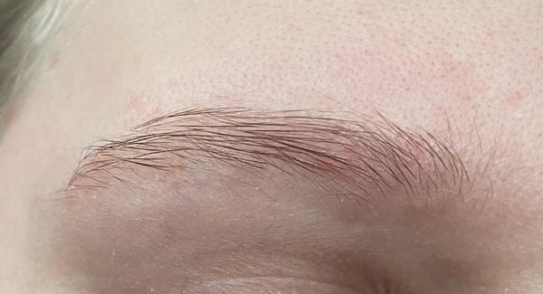 Ako riešiť problém so suchým obočím?