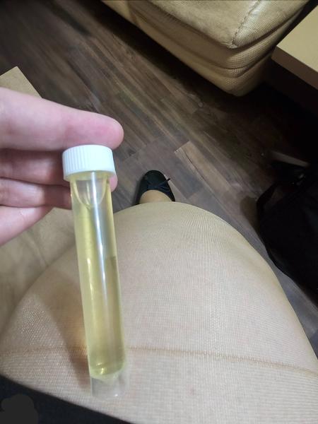 Cítim pálenie pri močení. Mám ísť na pohotovosť?