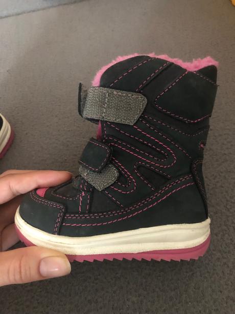 Detcké protetika čižmičky, protetika,19