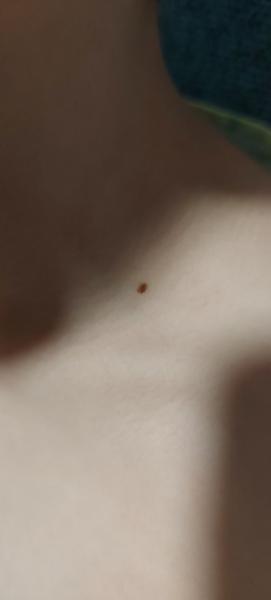 Je táto šošovička v poriadku?