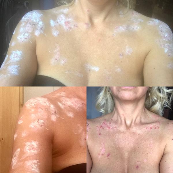 Špičkový dermatológ