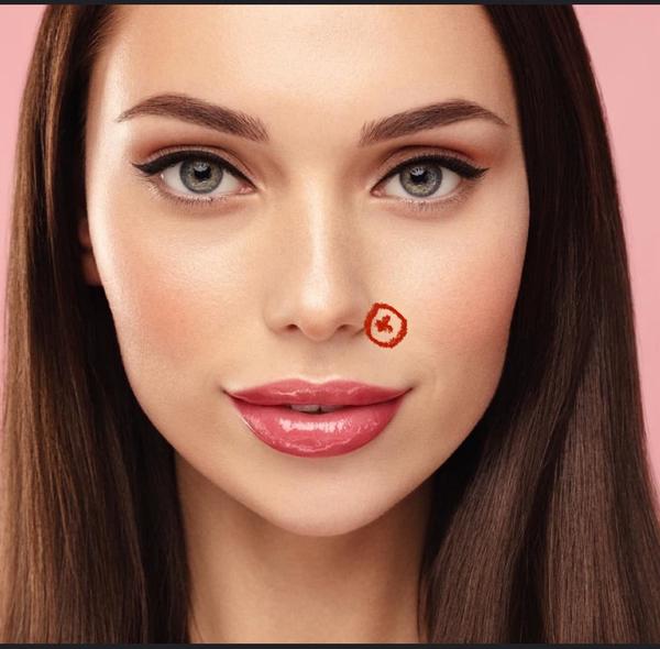 Hrčka pri nose: Čo môže byť príčinou?