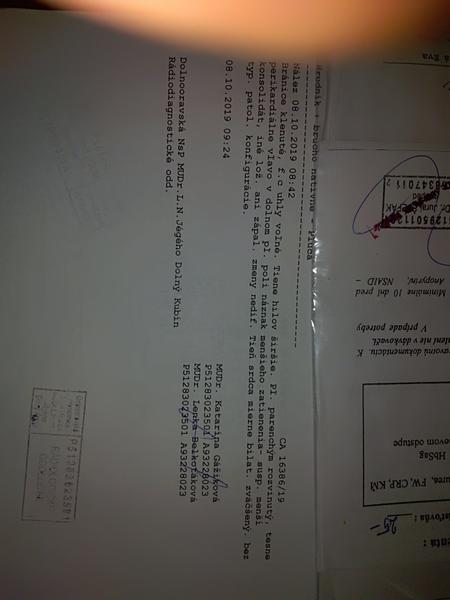 Rozumiete popisu z Rtg hrudníka?