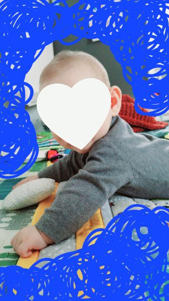 Je v poriadku, že sa 6-mesačná dcérka aktívne pretáča iba do jednej strany?