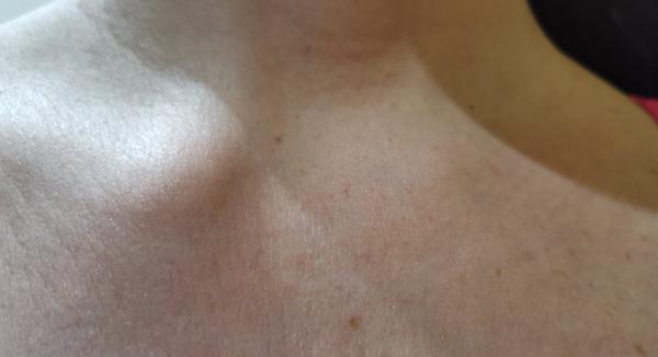 Čo sa mi deje s ramenom?