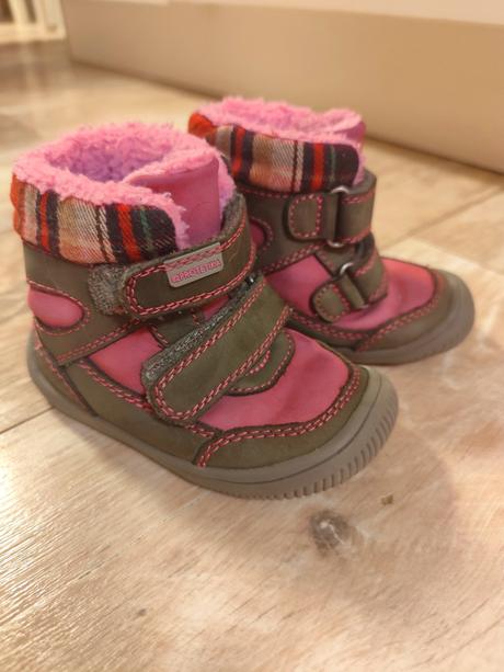 Zimné oteplene protetika, protetika,22