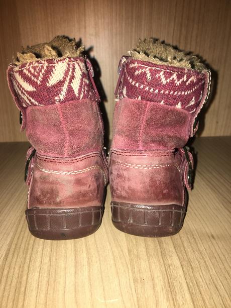 Zimné topánky protetika, protetika,22