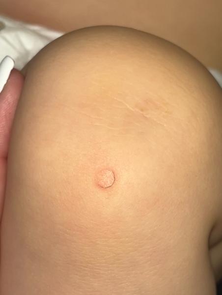 Čo sa deje s kolenom môjho syna?