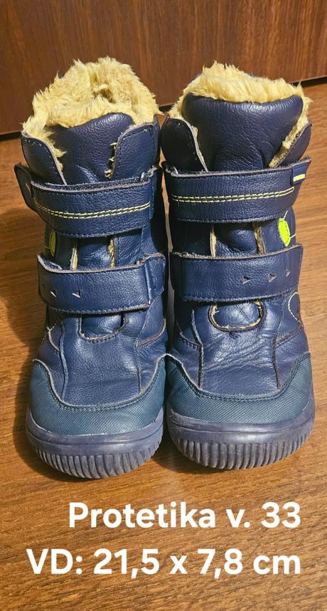 Zimne protetika toren v. 33, protetika,33