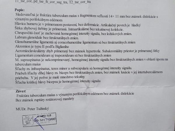 Vysvetlenie výsledku z MRI ramena