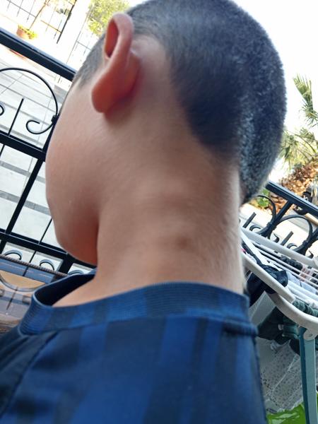 Čo môžu znamenať hrčky na krku dieťaťa?