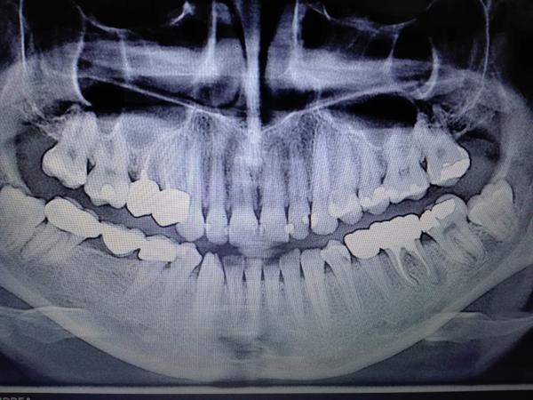 Vidíte na mojej snímke nejaké skryté kazy?