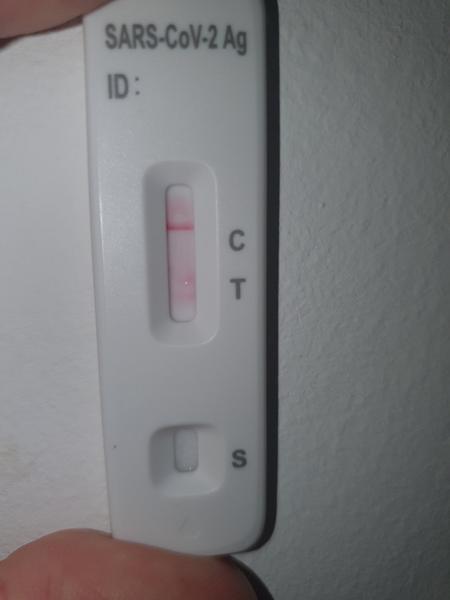 Je to pozitívny test na Covid-19?