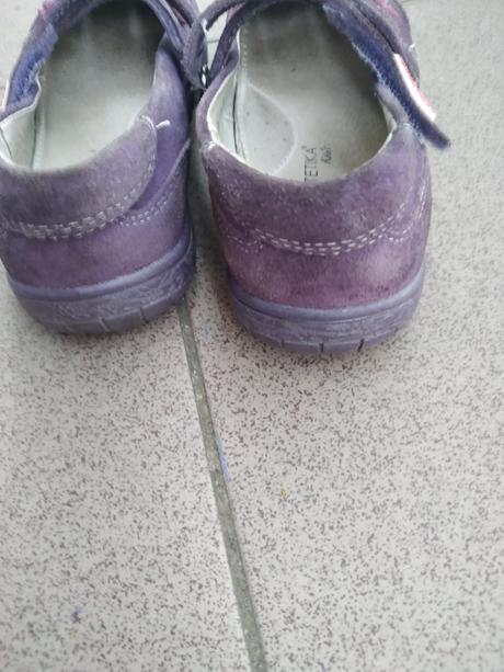 Milé topánočky protetika, protetika,28