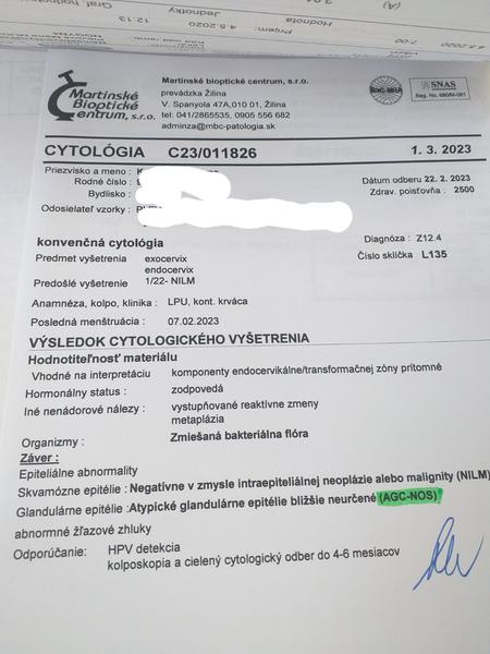 Čo znamená, keď mám epiteliálne abnormality?