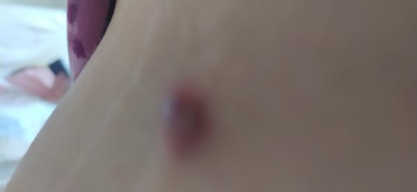 Čo to mám na boku?