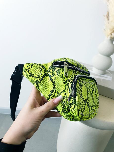 Extravagantná ľadvinka, primark