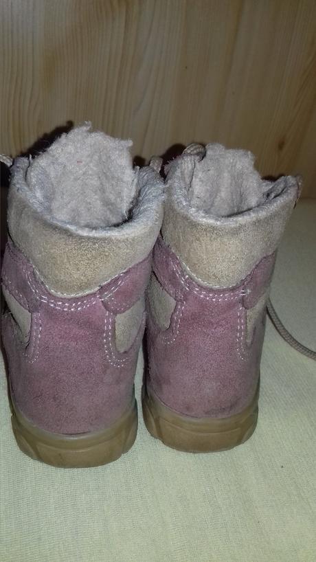 Zimna ortopedicka obuv, protetika,23