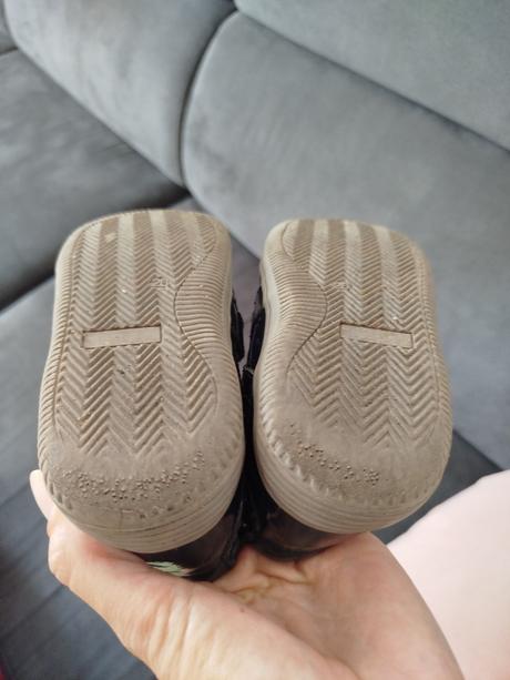 Protetika prechodné barefoot topánky, protetika,26