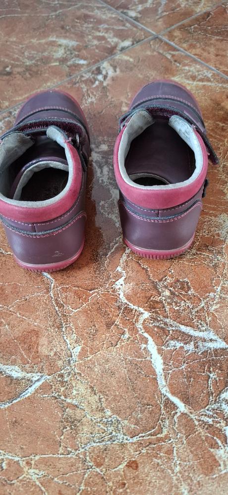 Prechodné topánky, protetika,26