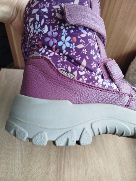 Protetika čižmy, protetika,38